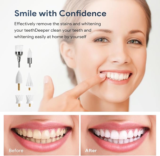 6 Tooth Polisher Replacement Brush Heads,Tooth Cleaning Replacement Set for Daily Tooth Cleaning,Whitening and Polishing for Electric Tooth Polishers